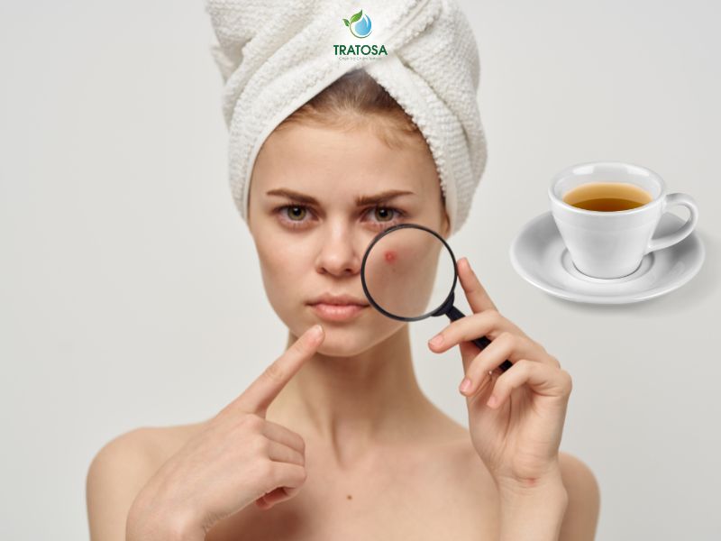 Những lưu ý khi sử dụng trà thảo dược trị mụn nội tiết