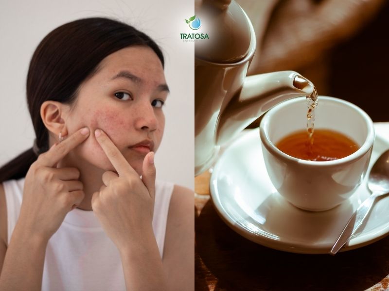 Ưu điểm khi sử dụng trà thảo dược trị mụn