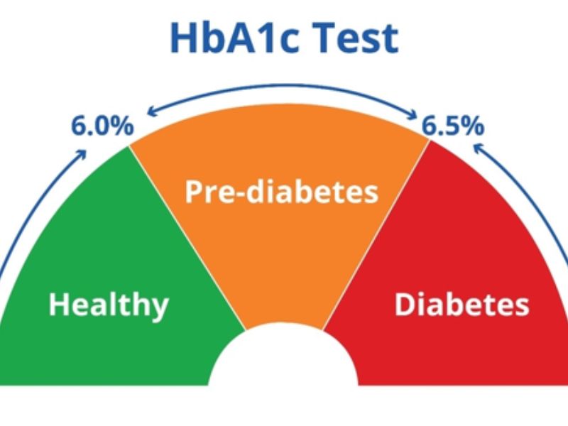 HbA1c phản ánh mức đường huyết trung bình trong 2 đến 3 tháng