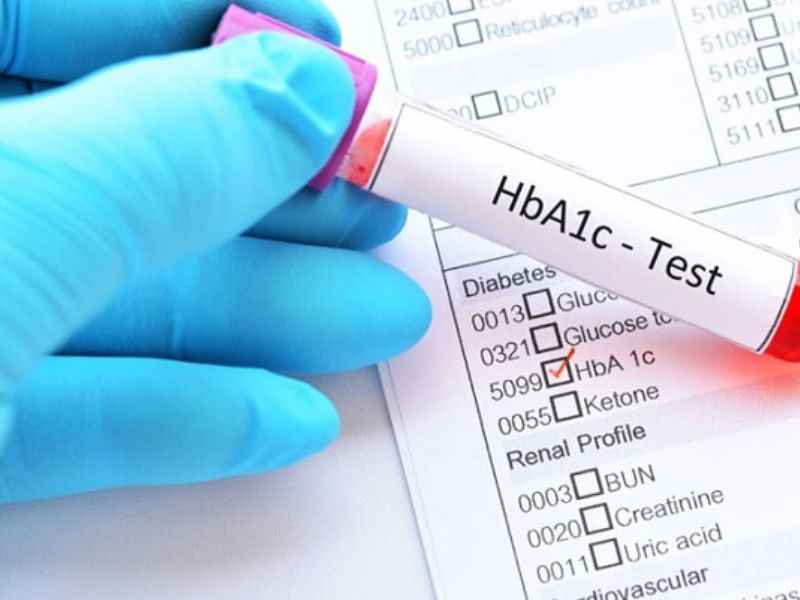 HbA1c phản ánh mức đường huyết trung bình trong 2 đến 3 tháng
