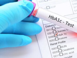 Xét nghiệm định kỳ giúp kiểm soát HbA1c hiệu quả