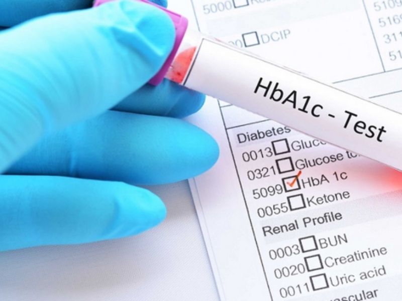 Xét nghiệm định kỳ giúp kiểm soát HbA1c hiệu quả