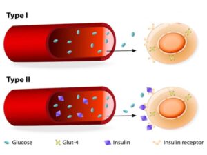 Phân biệt tiểu đường type 1 và type 2 qua cơ chế hoạt động của insulin