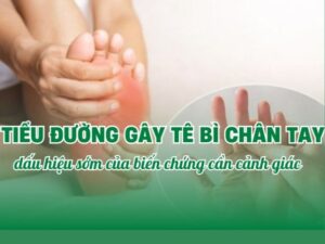 Tê tay chân có liên quan tiểu đường không và dấu hiệu cần cảnh giác